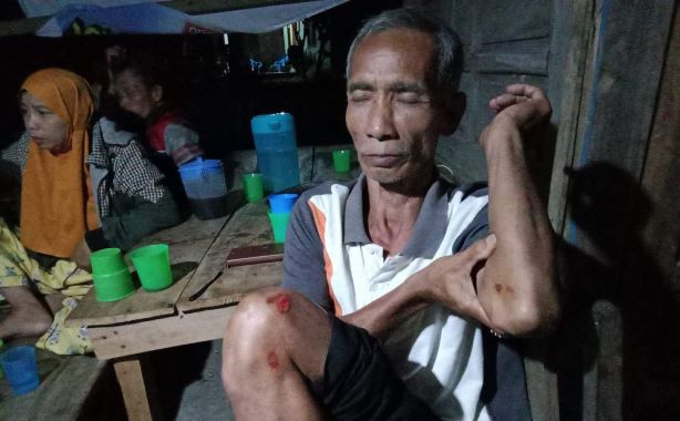 Abdul Gani korban penganiayaan yang dilakukan Feri. Foto Istimewa.